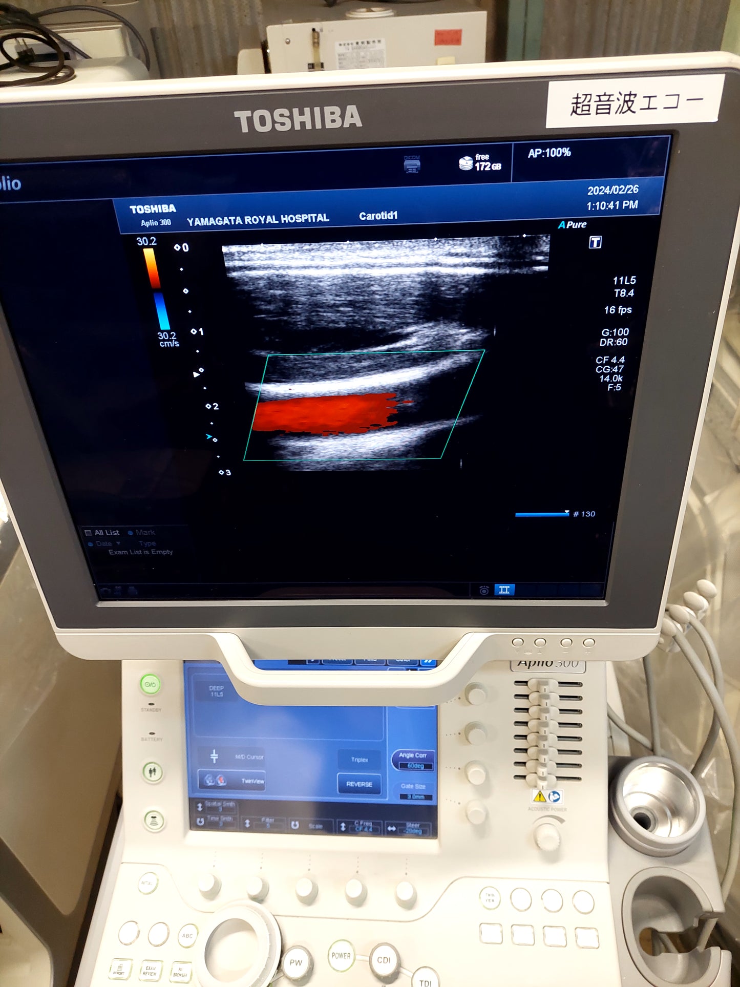 Toshiba Aplio 300 with Linear and cardiac probes. - Japan Medical Company LTD