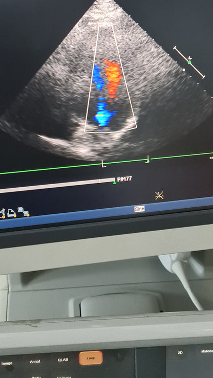 S5-1 philips prob cardiac