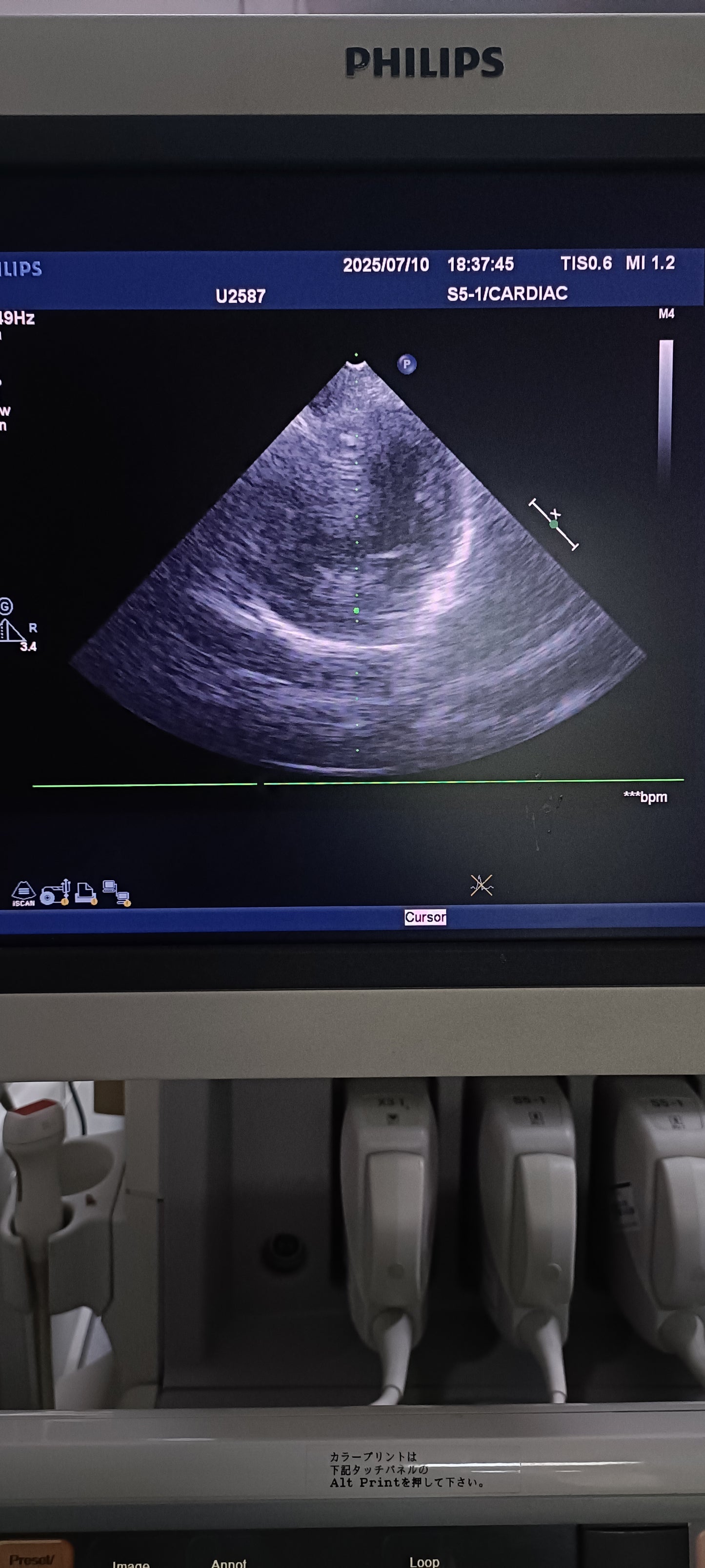 Philips s5-1 cardiac probe sn. 03FG2X checked dxb IS - Japan Medical Company LTD