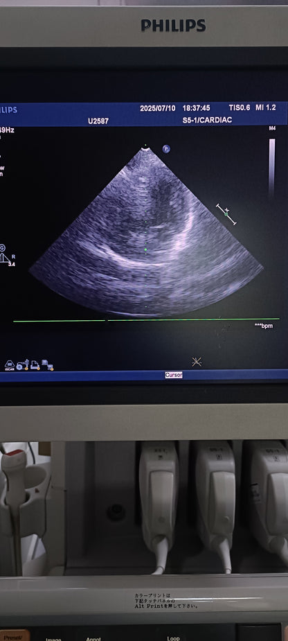 Philips s5-1 cardiac probe sn. 03FG2X checked dxb IS - Japan Medical Company LTD