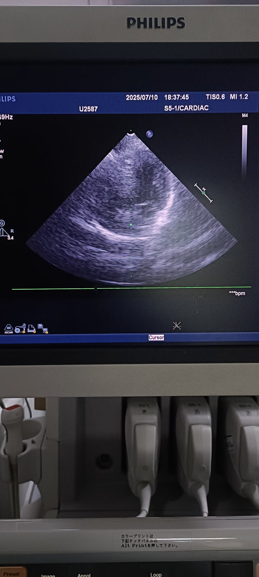 Philips s5-1 cardiac probe sn. 03FG2X checked dxb IS - Japan Medical Company LTD