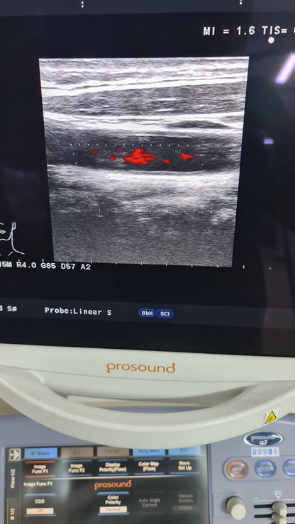 Aloka prob UST-5412 SN. M03744 checked