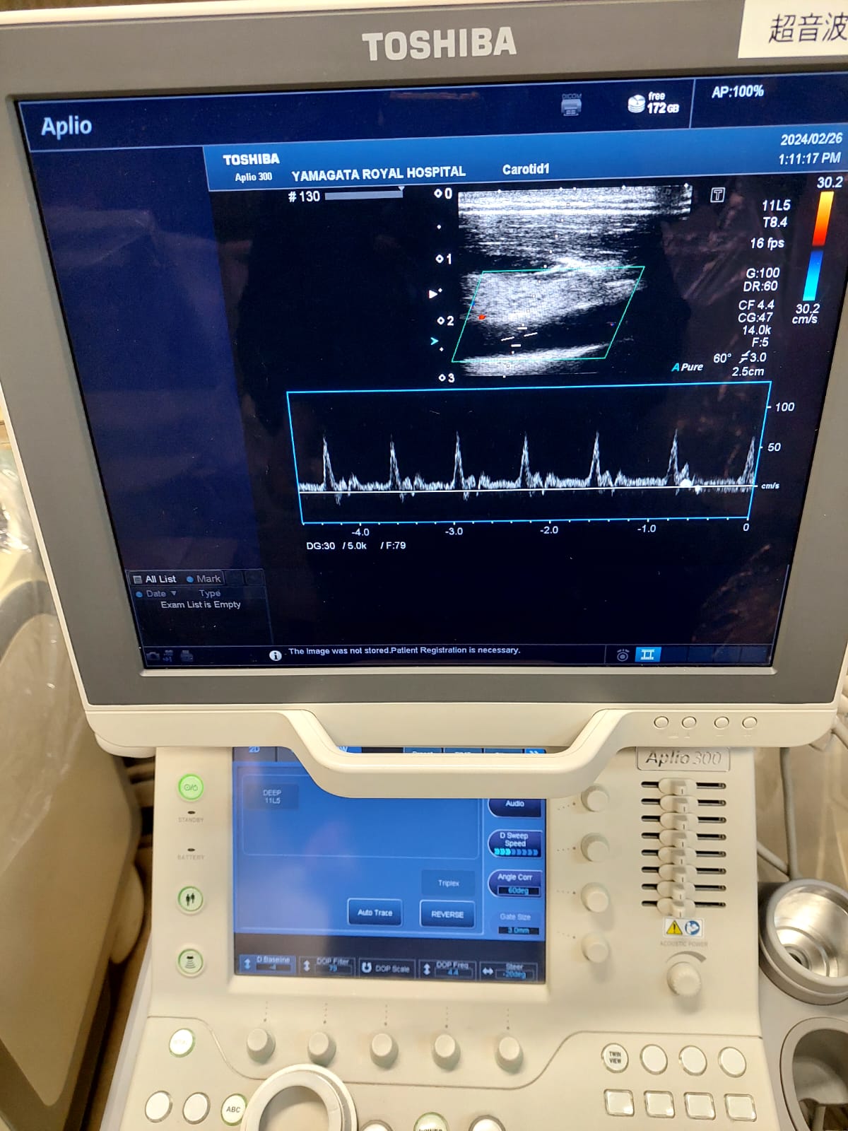 Toshiba Aplio 300 with Linear and cardiac probes. - Japan Medical Company LTD