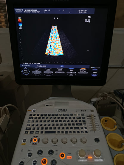P…Aloka UST-5299 cardiac UCprobe