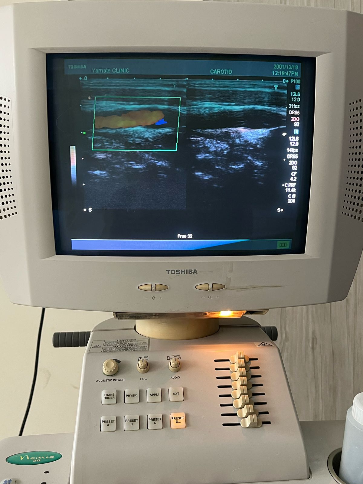 ...Toshiba PLM-805AT Linear Probe UC
