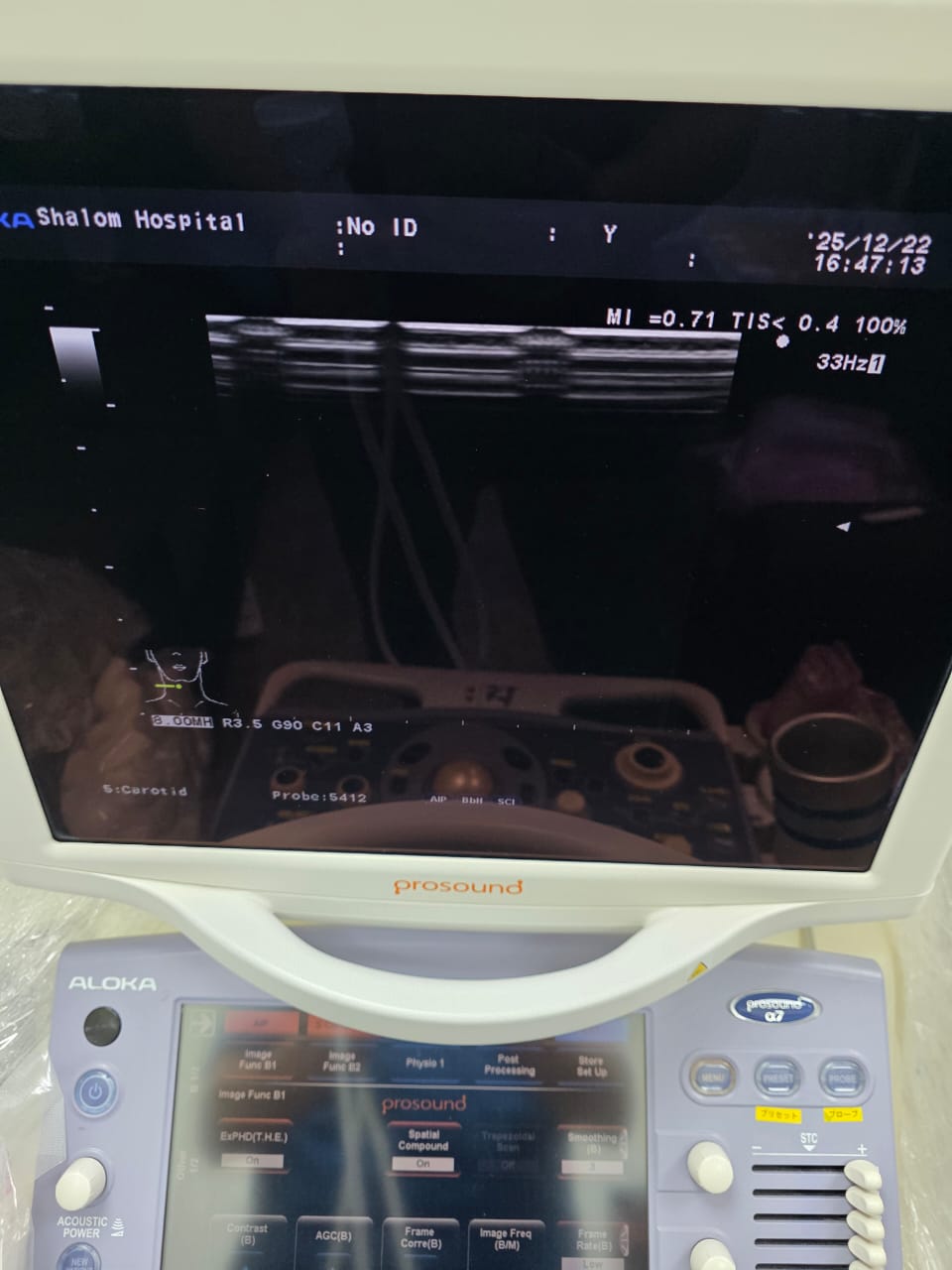 Aloka ust-5412 (MW) sn. 20177848 checked dxb - Japan Medical Company LTD