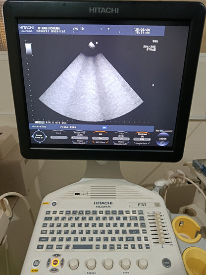 P…Aloka UST-5299 cardiac UCprobe
