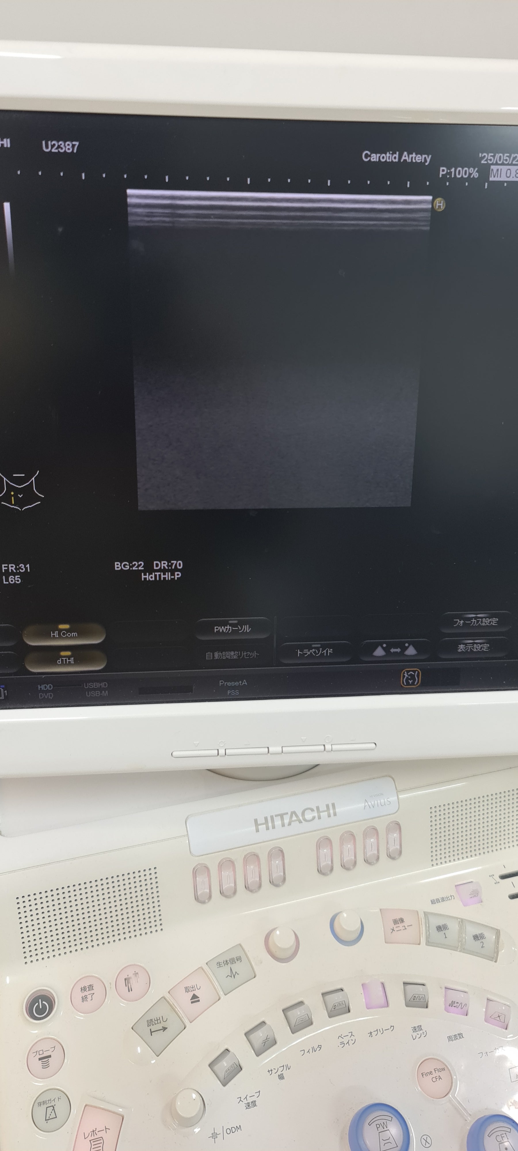 ..Hitachi EUP-L64 linear probe Checked DXB - Japan Medical Company LTD