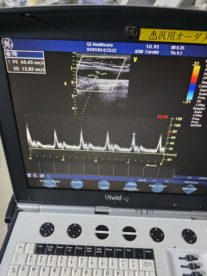 GE 12L RS linear probe SN: 132095YP1