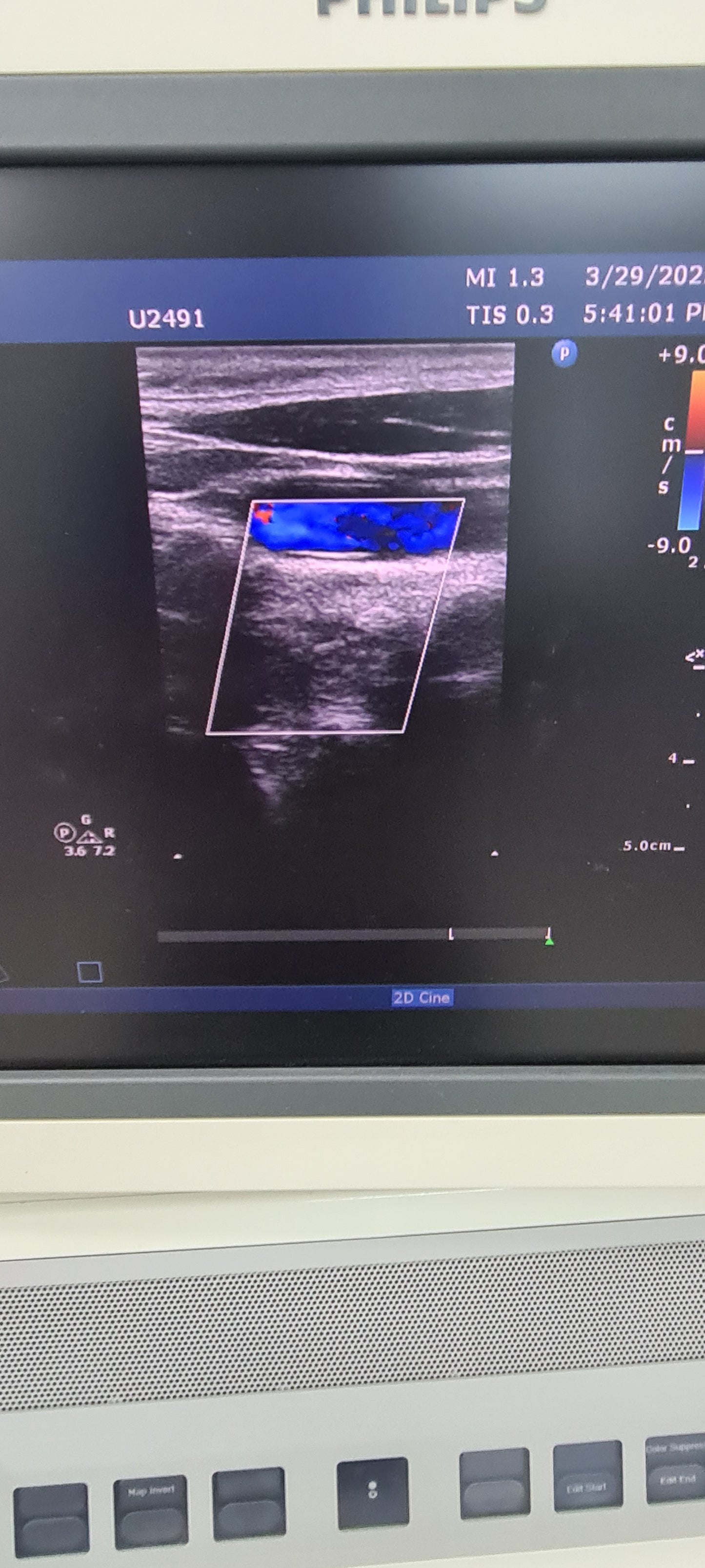 Philips L12-3 prob checked Ultrasound Transducer SN.2PFNQ PN. 453561182101