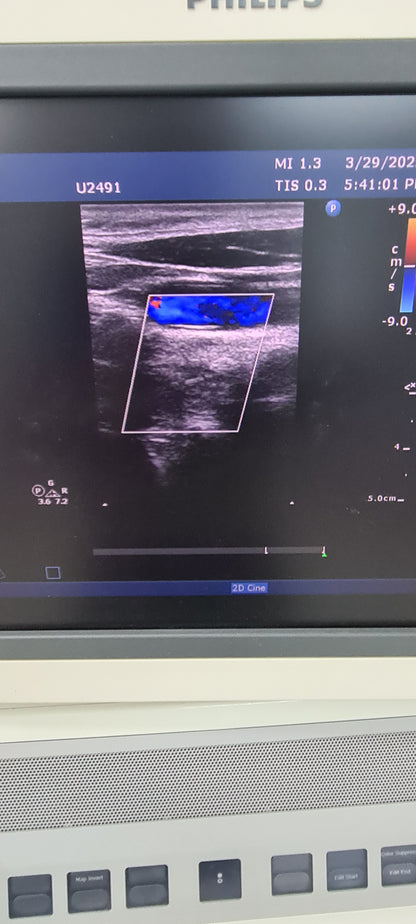 Philips L12-3 prob checked Ultrasound Transducer SN.2PFNQ PN. 453561182101