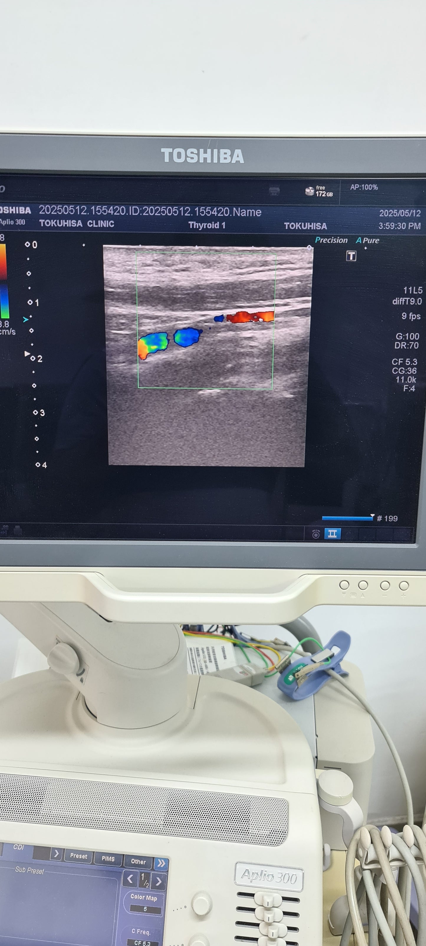 Toshiba PLT-704AT Convex Prob SN: 99A0635844 checked dxb