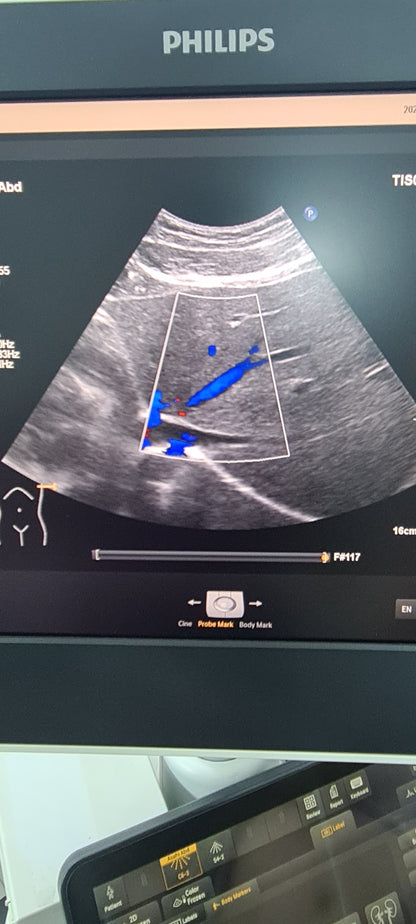 Philips C6-2 Convex probe SN: B16QFF checked DXB