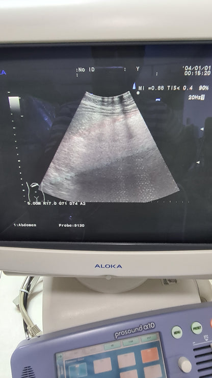 Aloka UST-9130 CONVEX SN. X00C0448 CHECKED