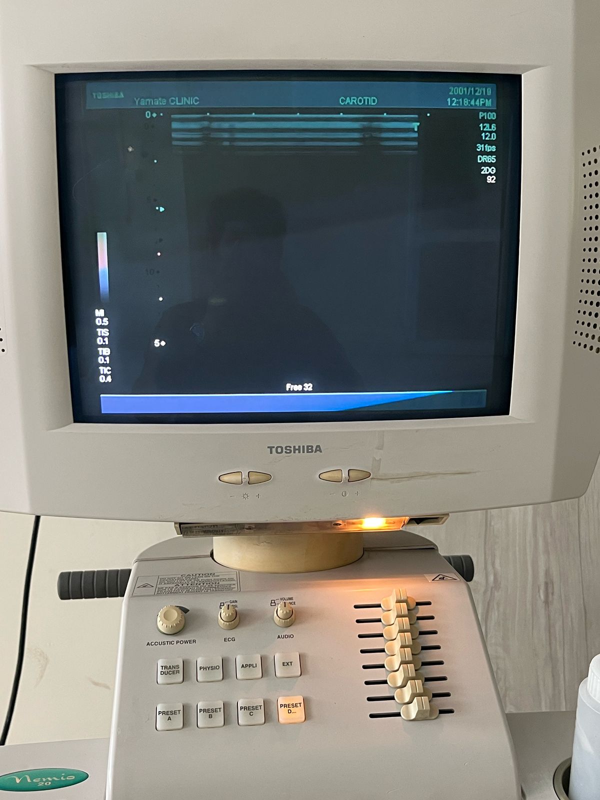 ...Toshiba PLM-805AT Linear Probe UC