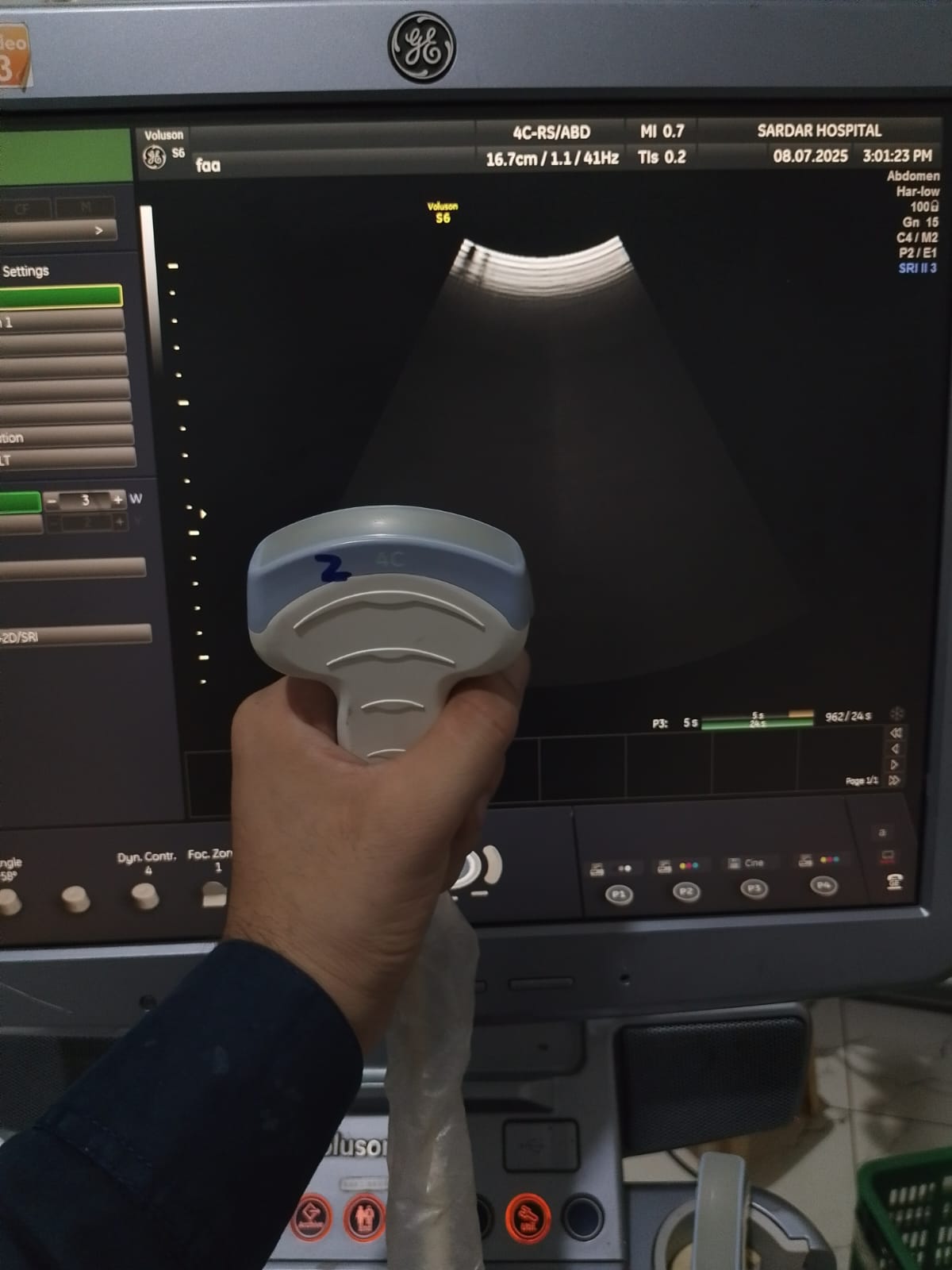 P..4c-Rs convex probe (2)