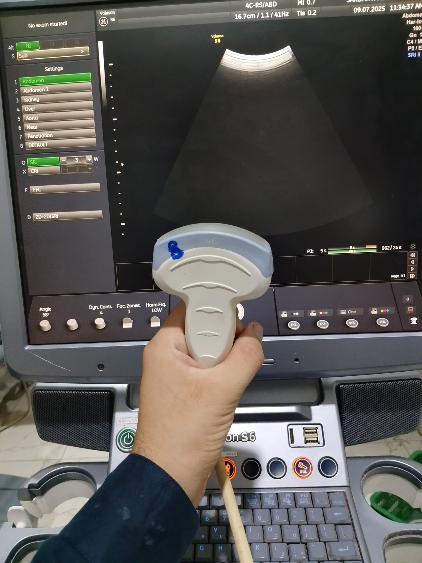 P..4c-Rs convex probe (8)