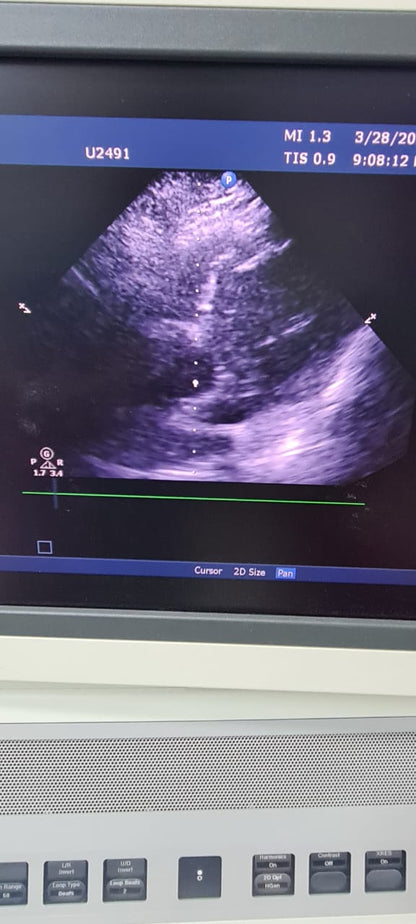 Philips S5-2 Prob cardiac checked