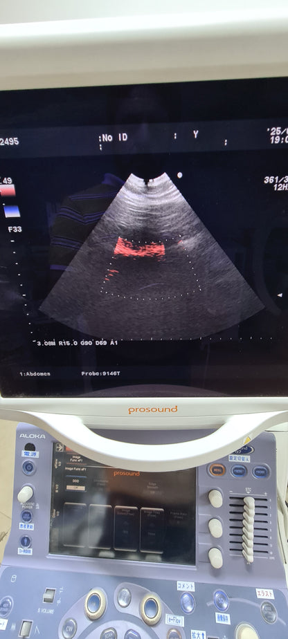 Aloka UST-9146T Micro Convex checked Av SN.20050115