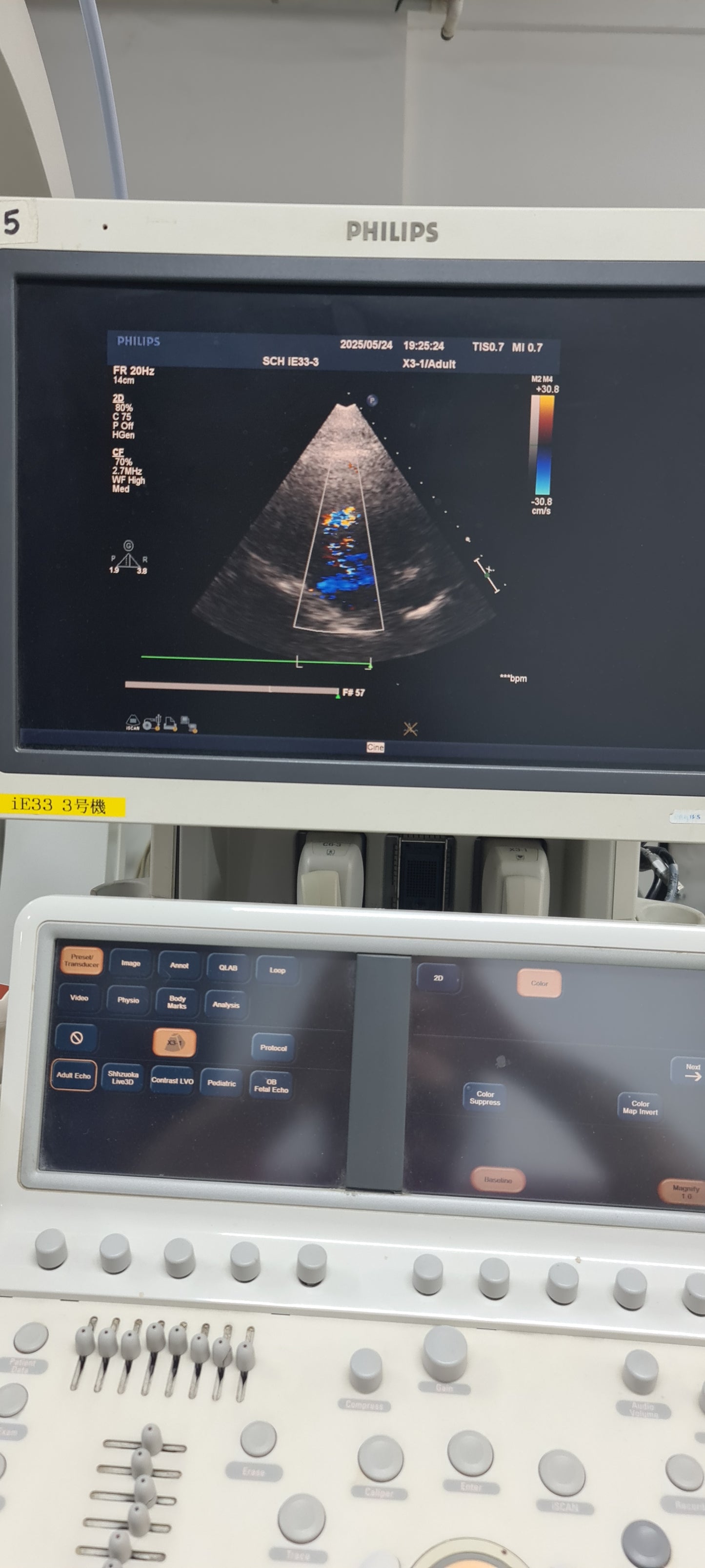 Philips X3-1 Matrix Array Probe SN: 02YKFK Checked dxb