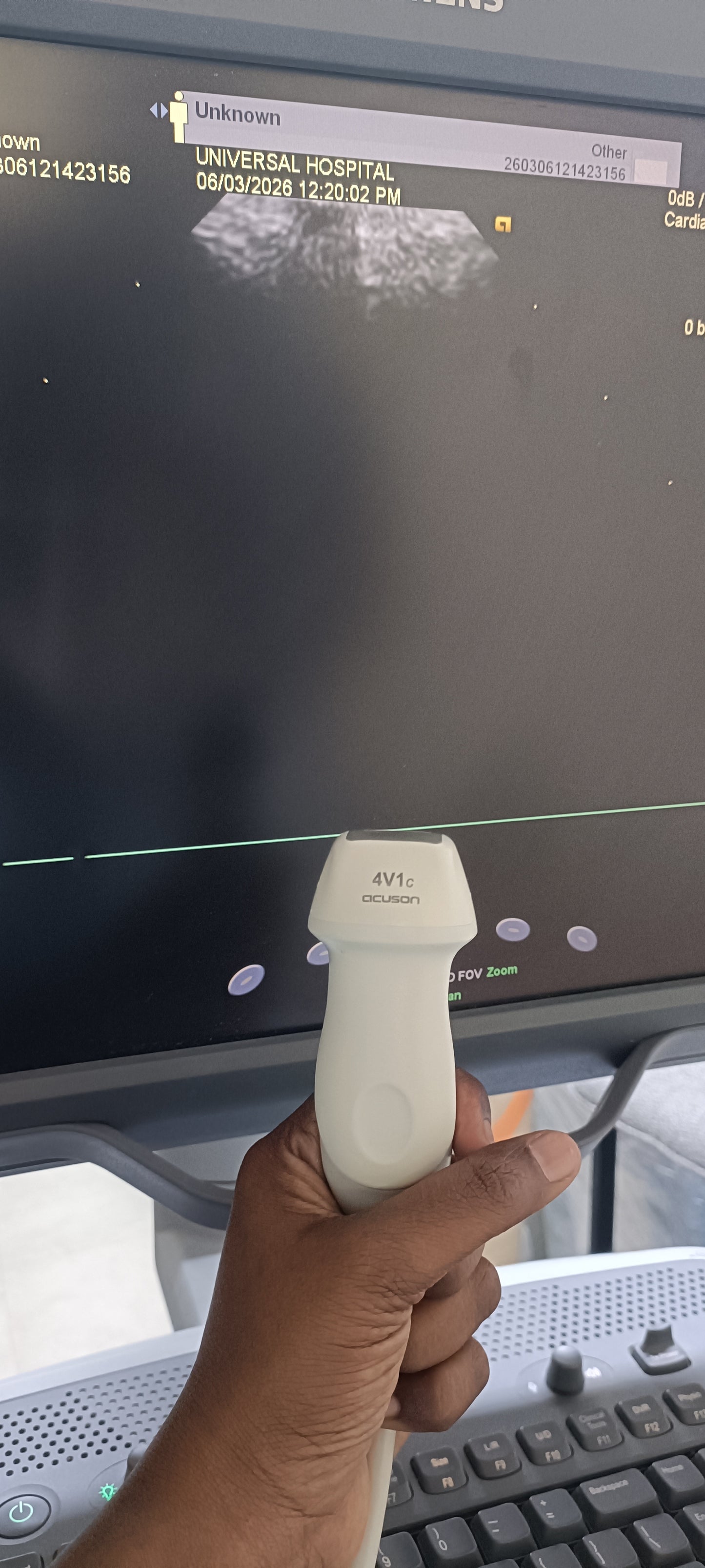 Siemens cardiac probe sn. (21)71912056 moy. 2017 checked dxb IS (MW) - Japan Medical Company LTD