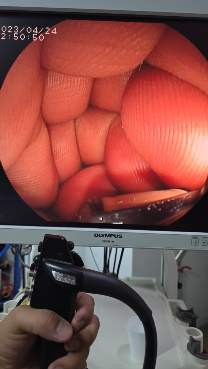Fujinon gastroscopy EG-530UT2 S.NO: 1U038A021 checked DXB