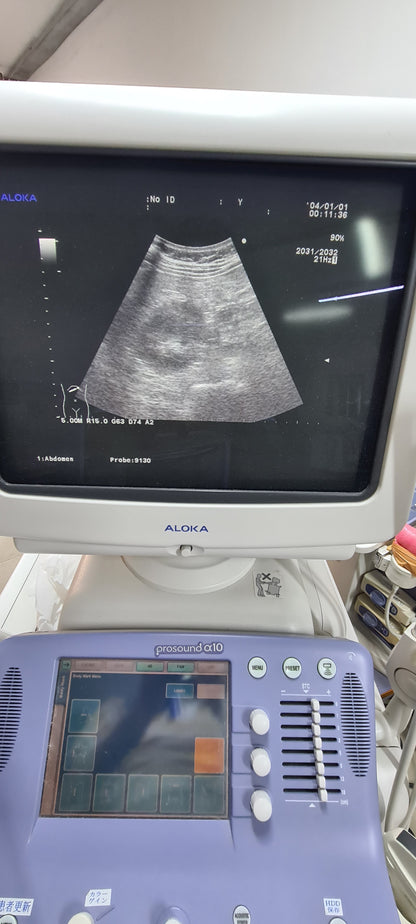 Aloka UST-9130  CONVEX checked Av. SN. X0061338