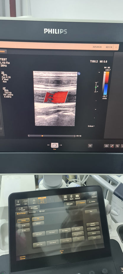 Philips L15-7io Hockey stick Prob  SN: B0K8N4 checked DXB