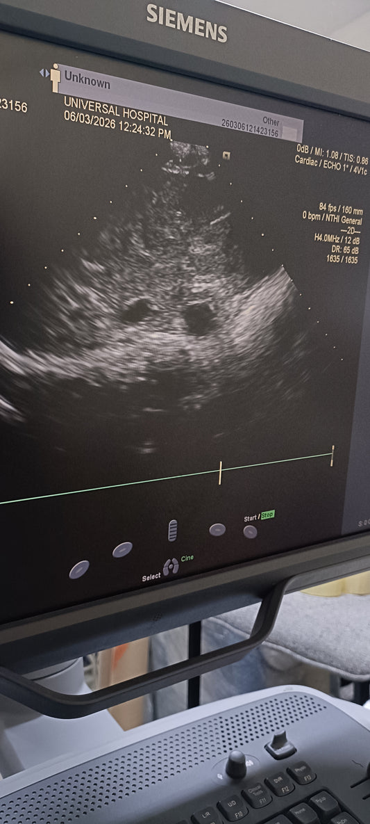 Siemens cardiac probe sn. 00485607 moy. 2010 checked dxb IS (MW) - Japan Medical Company LTD