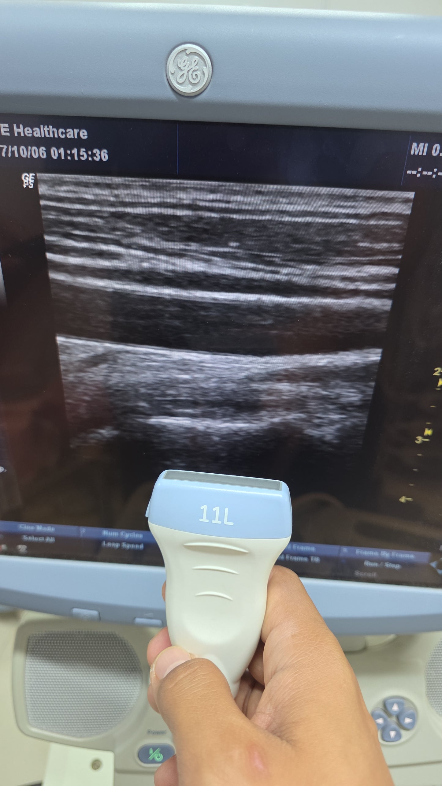 GE 11L Linear probe for logiq p5,p6 mfg: 2012 Checked DXB