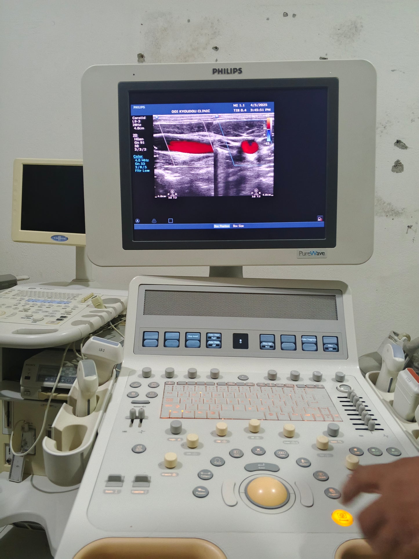 P...Philips L9-3 Linear Probe