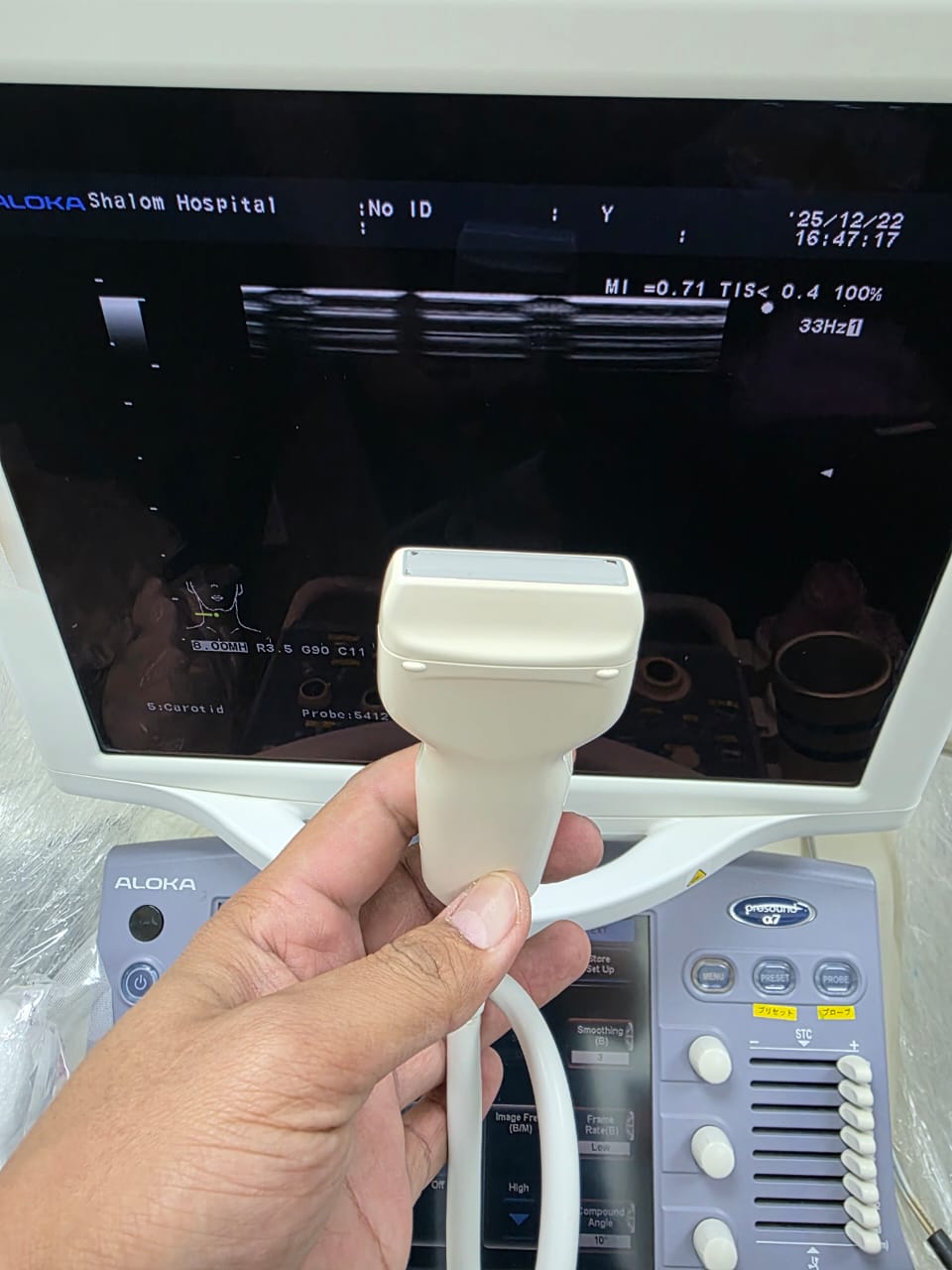 Aloka ust-5412 (MW) sn. 20177848 checked dxb - Japan Medical Company LTD