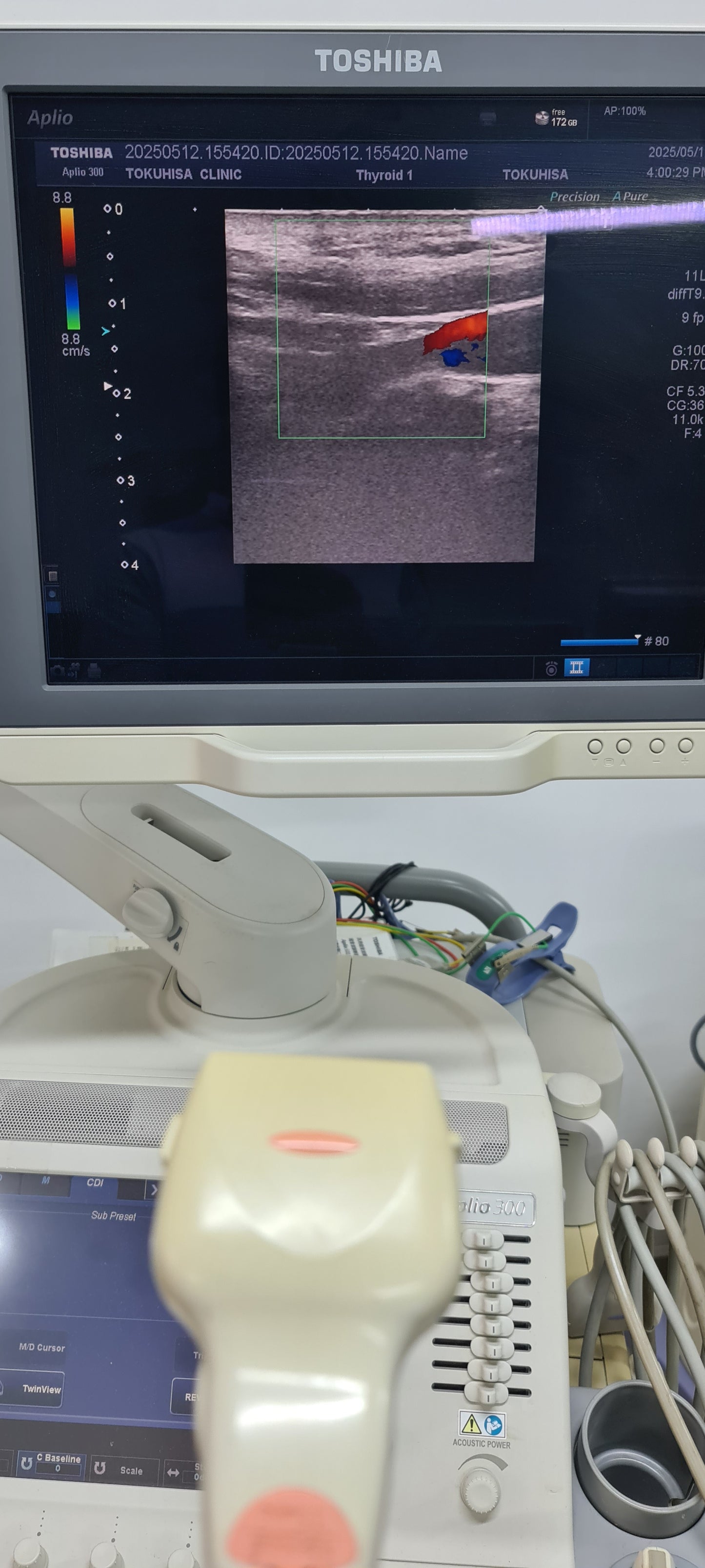 Toshiba PLT-704AT Convex Prob SN: 99A0635844 checked dxb