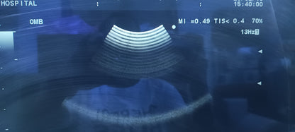 Aloka ust-9132t sn. 206h2728 (MW) checked dxb IS - Japan Medical Company LTD