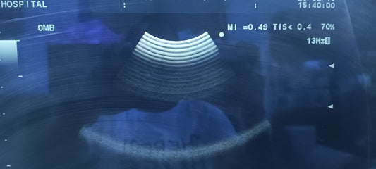 Aloka ust-9132t sn. 206h2728 (MW) checked dxb IS - Japan Medical Company LTD