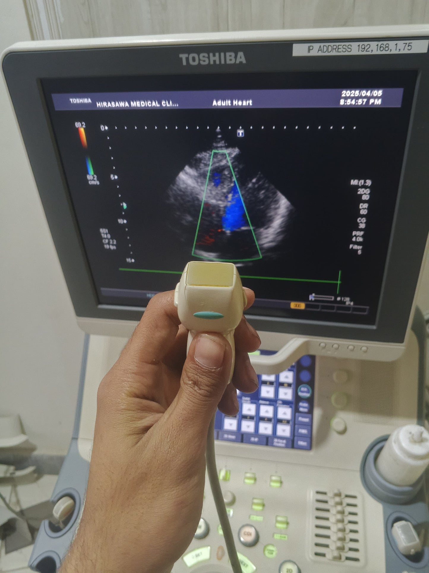 Toshiba PST-25BT cardiac probe
